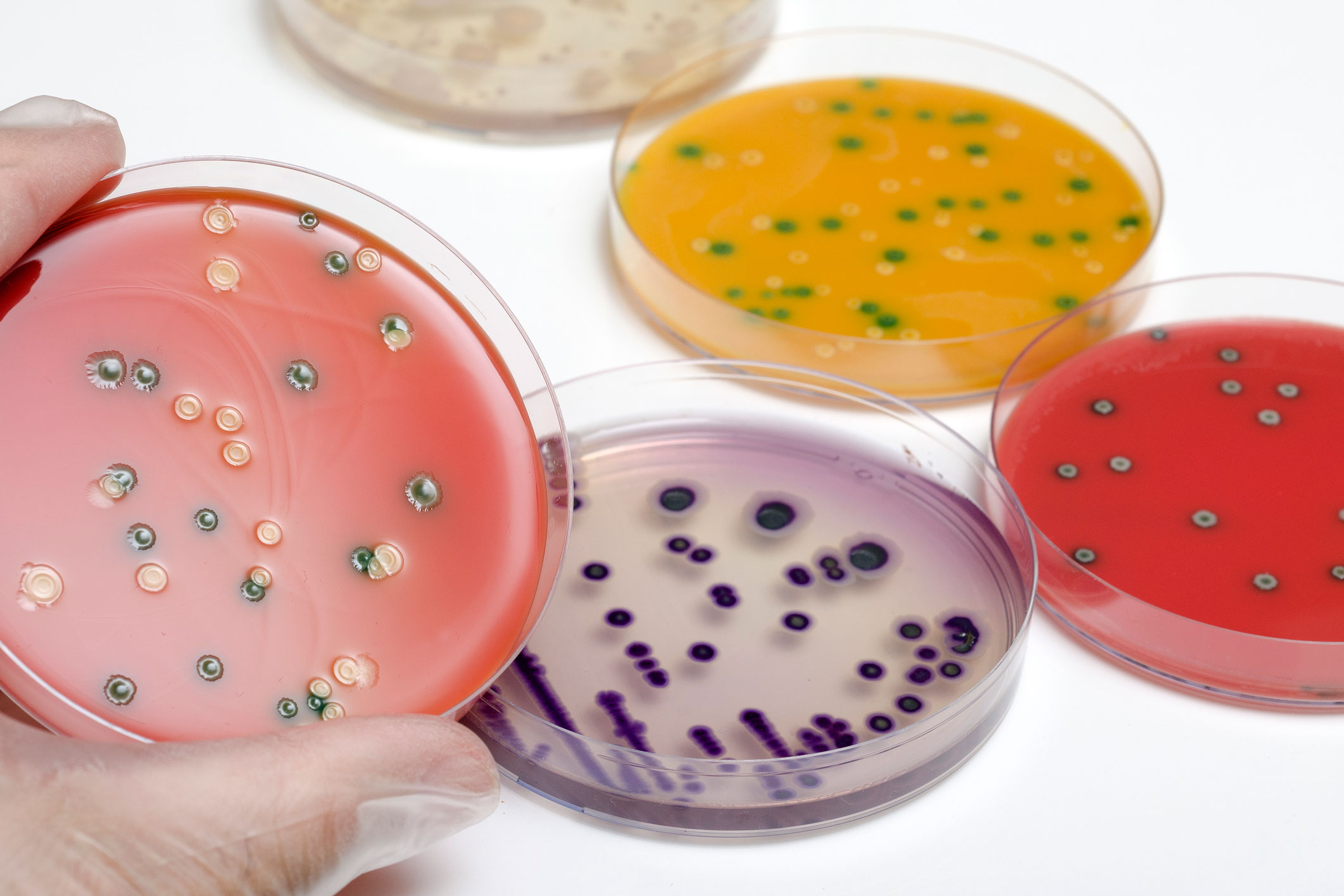 Бактерии домашних условиях