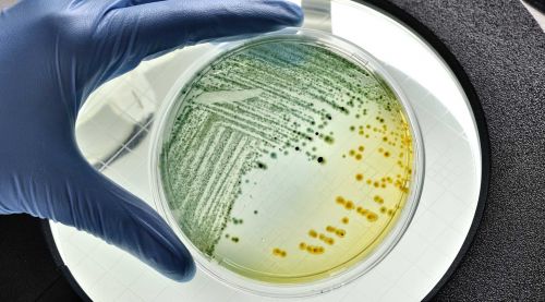 E coli